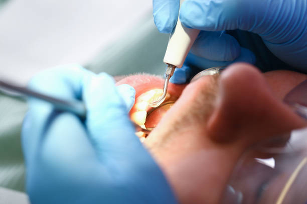 Best Emergency Treatment for Toothache in Bel Air North, MD