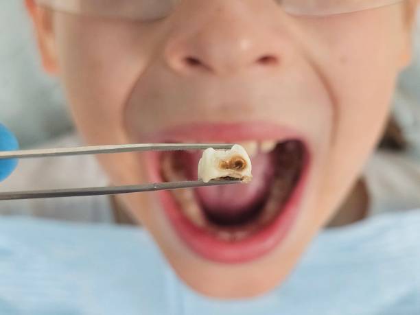 Best Weekend Emergency Dentist in Bel Air North, MD